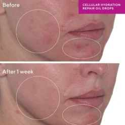 CELLULAR HYDRATION REPAIR OIL DROPS 30 ML