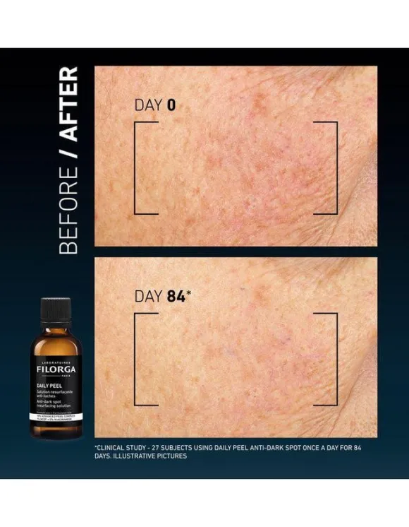 Clinical Home Peel Dark Spot 50 ml
