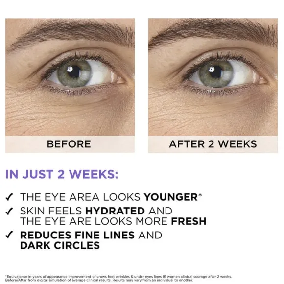 Revitalift Filler 2. 5% Hyaluronic Acid+Caffeine Eye Serum 20ml