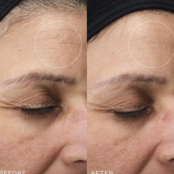 Sleep Glycolic